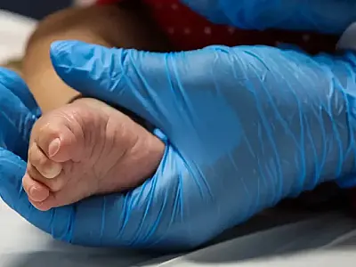 Dia Nacional do Teste do Pezinho: IPED/APAE é referência na triagem Neonatal em MS
