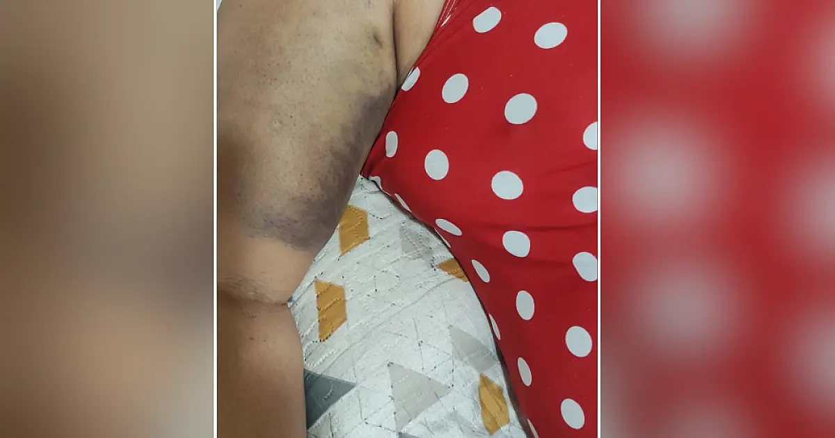 Cansada da espera na Capital, mulher consegue atendimento urgente em Corumbá