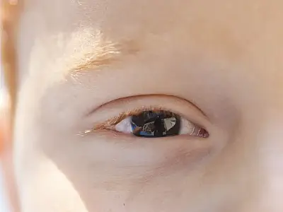 Erros de refração são principal causa de deficiência visual infantil