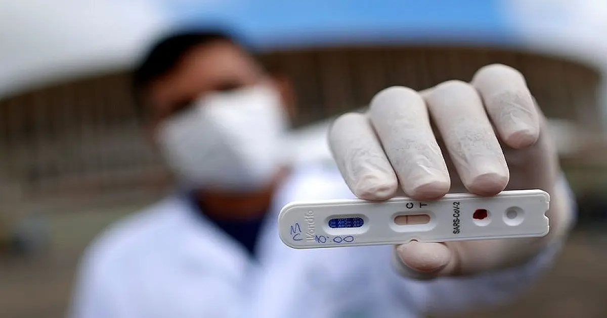 Com 533 positivos em 24 horas, MS ultrapassa 70 mil notificações