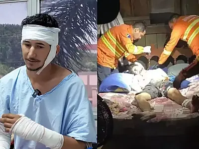 Peão detalha como se salvou do ataque brutal de onça no Pantanal