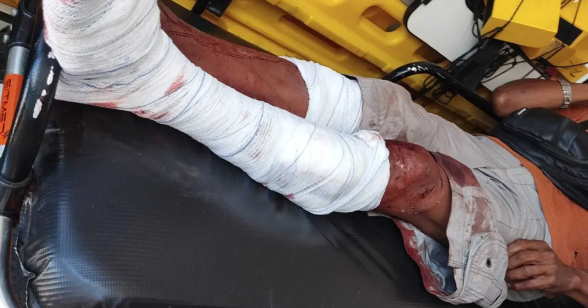 Homem é atacado por dois cães em Corumbá e sofre ferimentos nas pernas