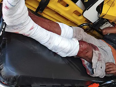 Homem é atacado por dois cães em Corumbá e sofre ferimentos nas pernas