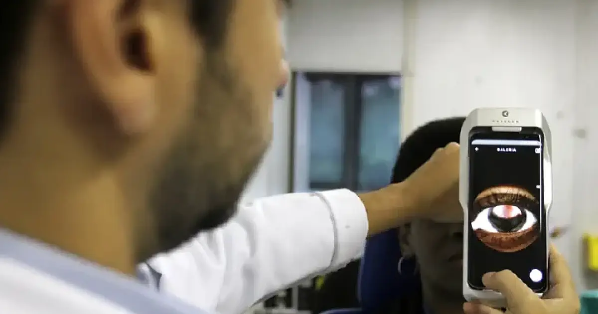 Saúde de MS alerta para mutirões oftalmológicos irregulares no Estado