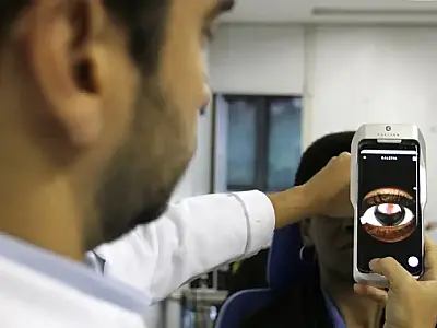 Saúde de MS alerta para mutirões oftalmológicos irregulares no Estado