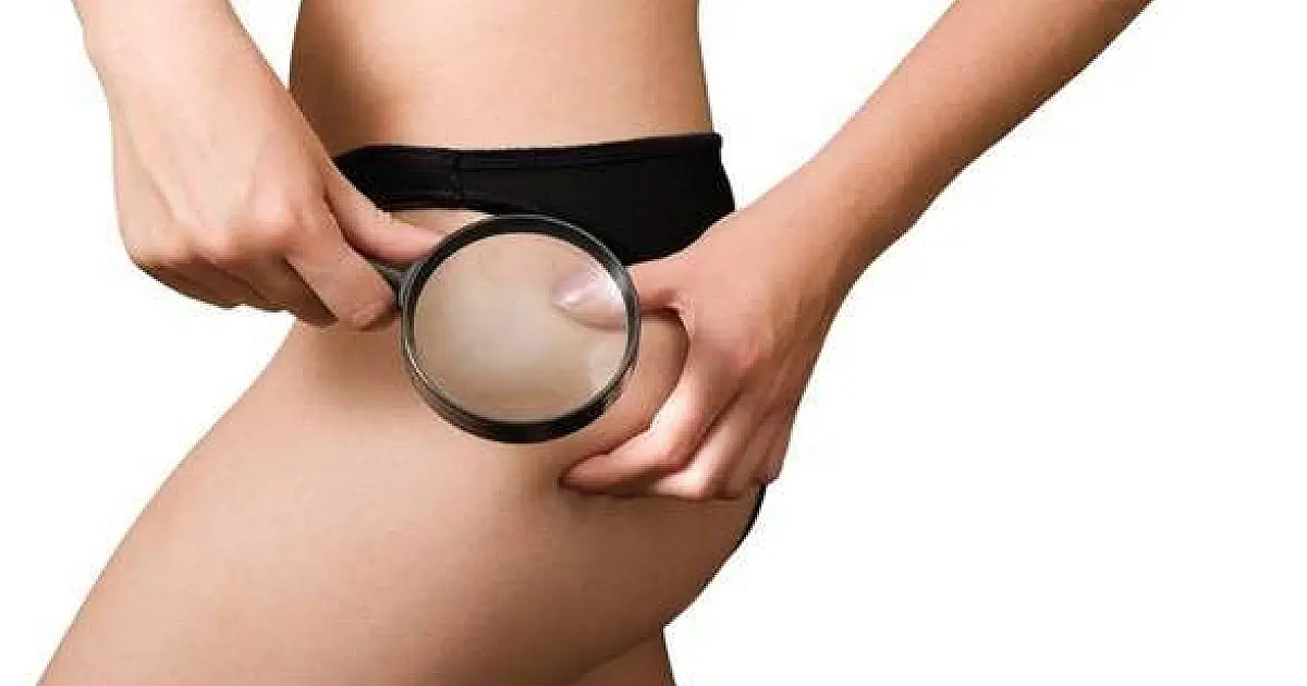 Proibido e letal, mulheres colocam até 12 litros de silicone industrial