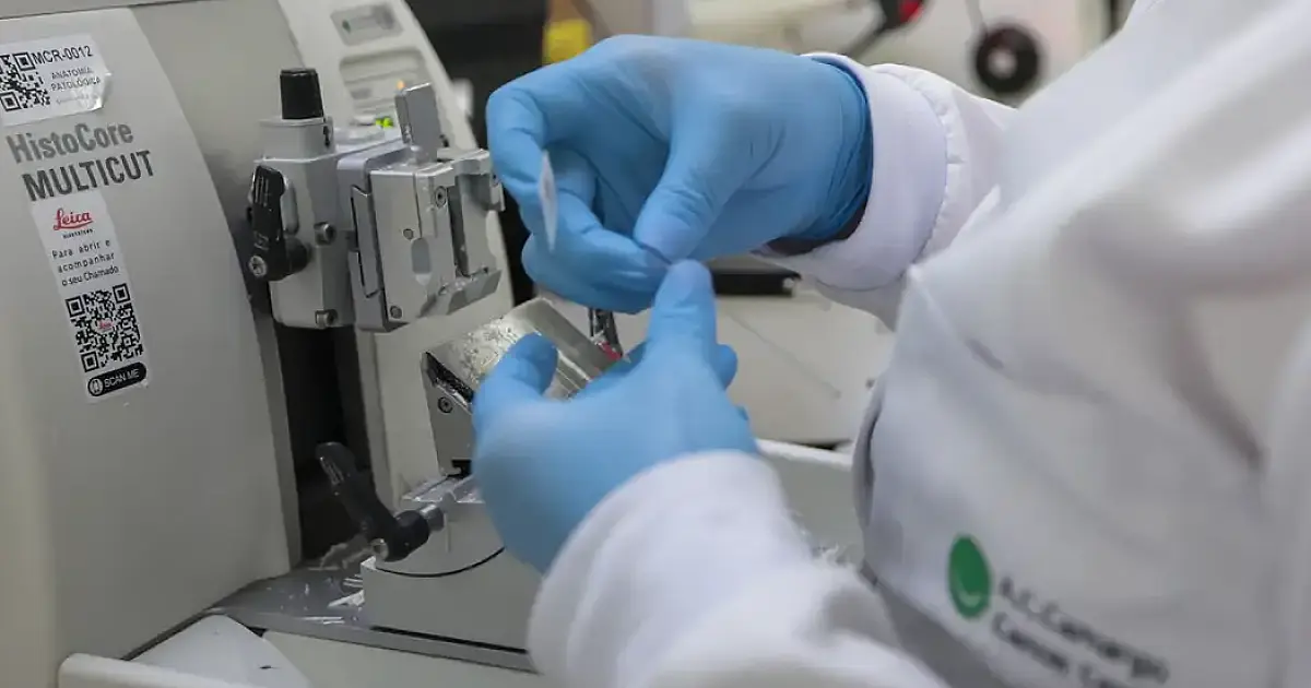 Cura de câncer de próstata pode chegar a até 98%