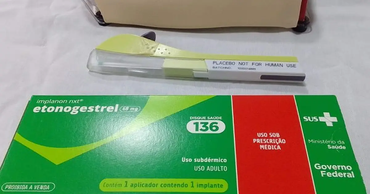 Saiba como acessar DIU e implante subdérmico pelo SUS em MS