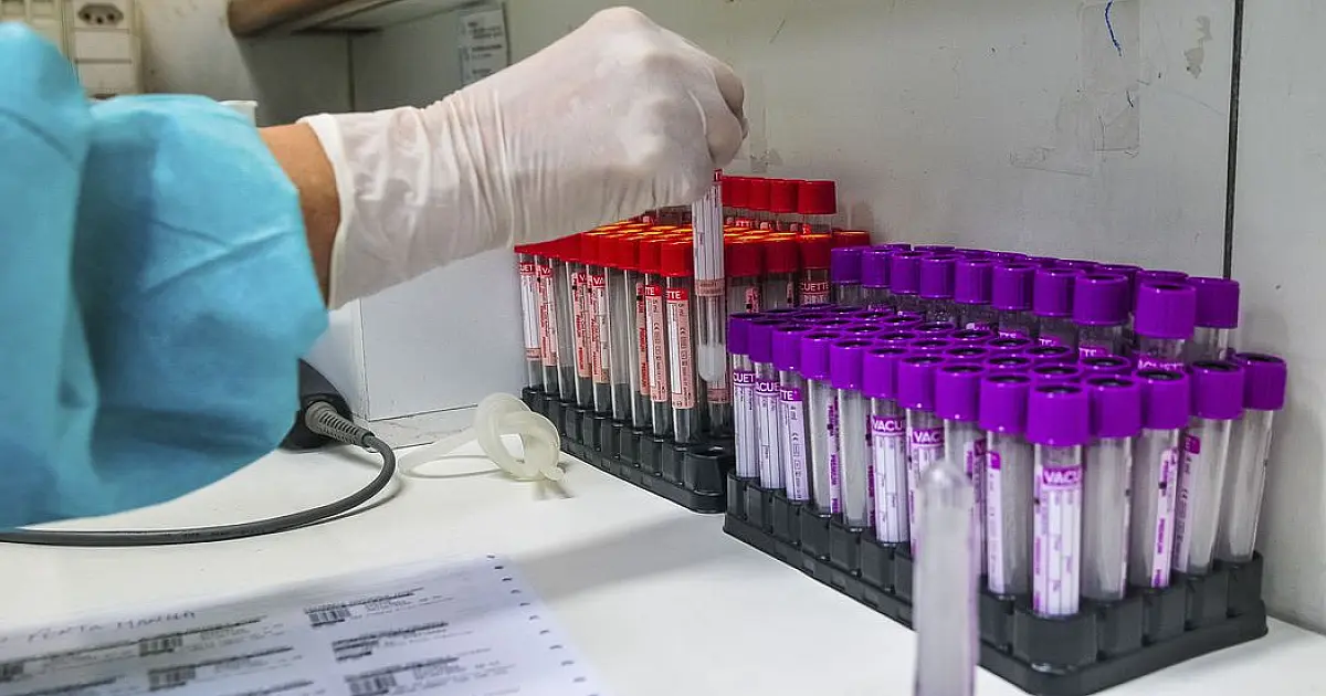 Estado tem 743 novos positivos e Corumbá registra 35