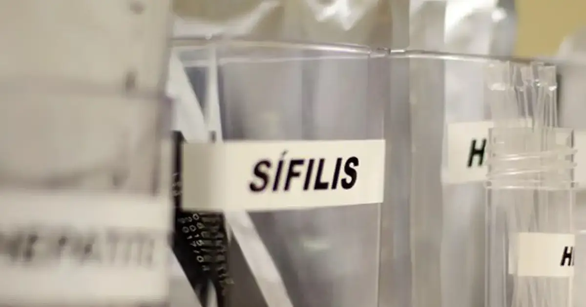 SUS passa a adotar antibiótico para prevenir sífilis e clamídia
