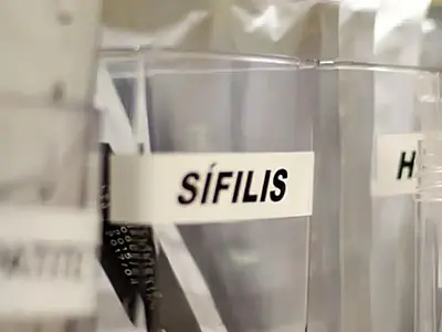 SUS passa a adotar antibiótico para prevenir sífilis e clamídia