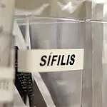 SUS passa a adotar antibiótico para prevenir sífilis e clamídia