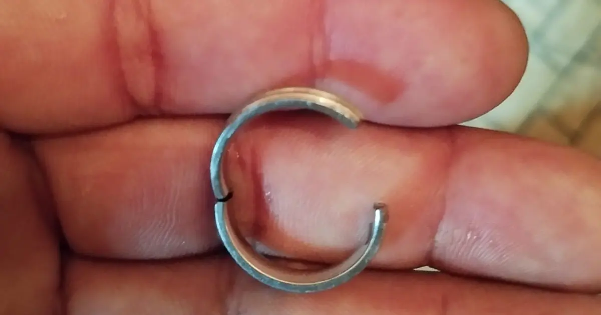 Bombeiros socorrem criança de 9 anos com anel preso no dedo