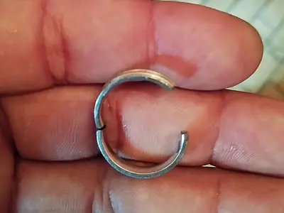 Bombeiros socorrem criança de 9 anos com anel preso no dedo