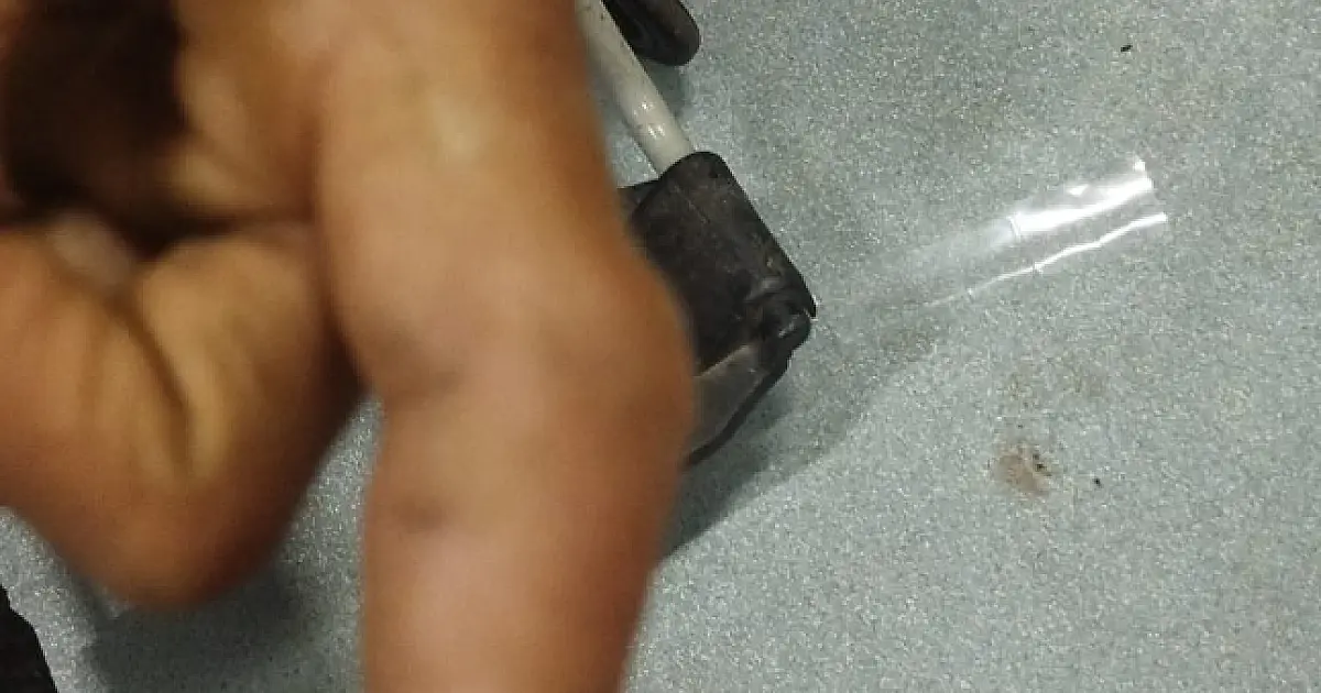 Homem é picado por serpente “boca-de-sapo” na região da Codraza