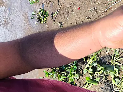 Homem picado por escorpião é resgatado no Pantanal