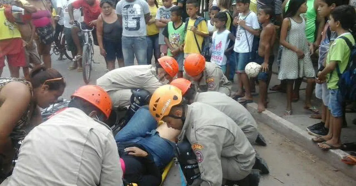 Passageira de moto sofre fratura exposta em colisão