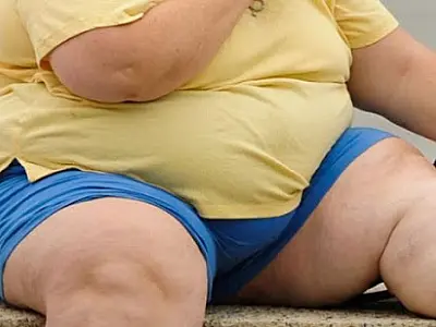 Comitê com 14 ministérios vai coordenar política contra obesidade