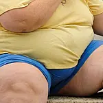 Comitê com 14 ministérios vai coordenar política contra obesidade