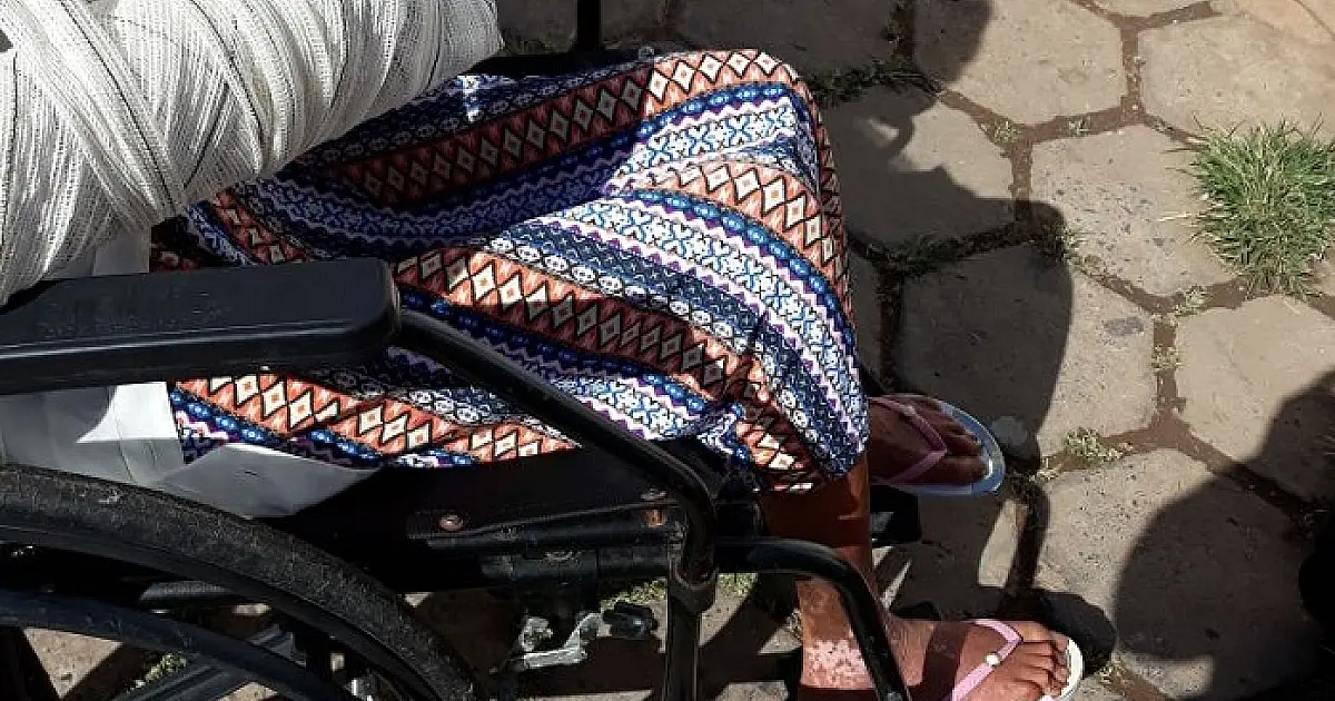 Idosa escorrega e fratura o punho