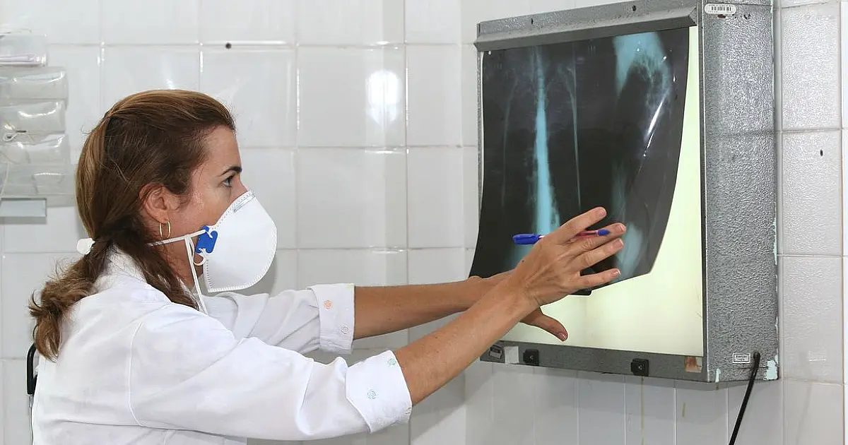 Pandemia reduz avanços no combate à tuberculose, diz especialista