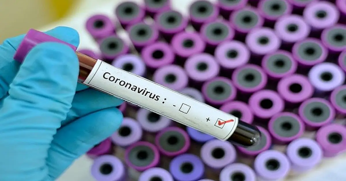 Estado de MS registra mais 59 vidas perdidas pela pandemia