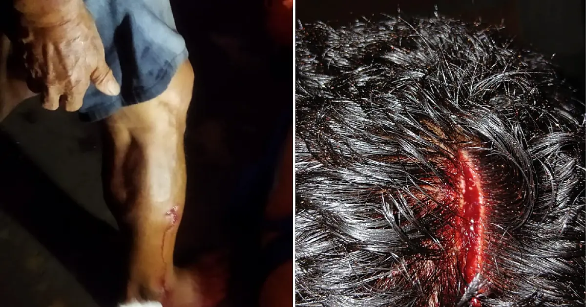 Idoso atacado por Pitbull sofre ferimentos na perna e cabeça