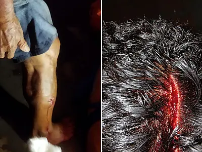 Idoso atacado por Pitbull sofre ferimentos na perna e cabeça