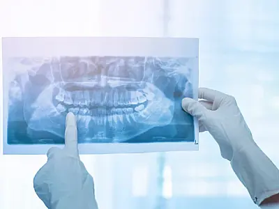 Corumbá recebe recurso federal para compra de raio-X odontológico panorâmico