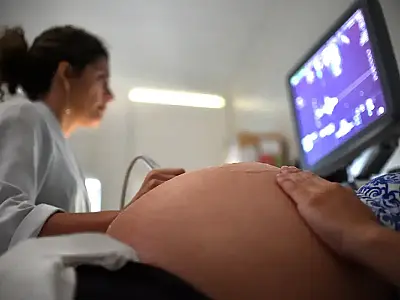 Mortalidade materna reduz de 22 para 15 nos últimos cinco anos em MS