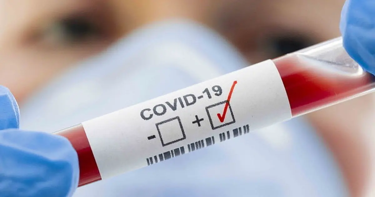 424 testam positivo para COVID-19 em Corumbá