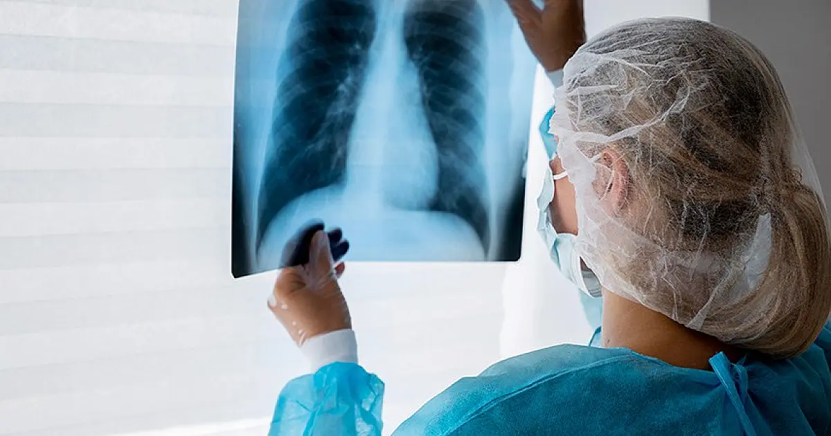 Lei institui campanha para conscientização sobre câncer de pulmão