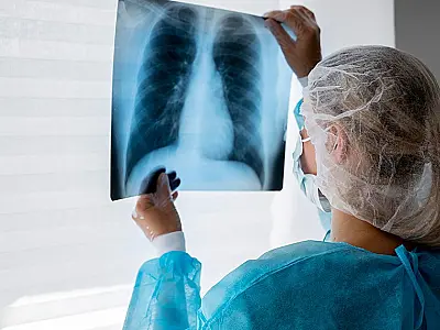 Lei institui campanha para conscientização sobre câncer de pulmão