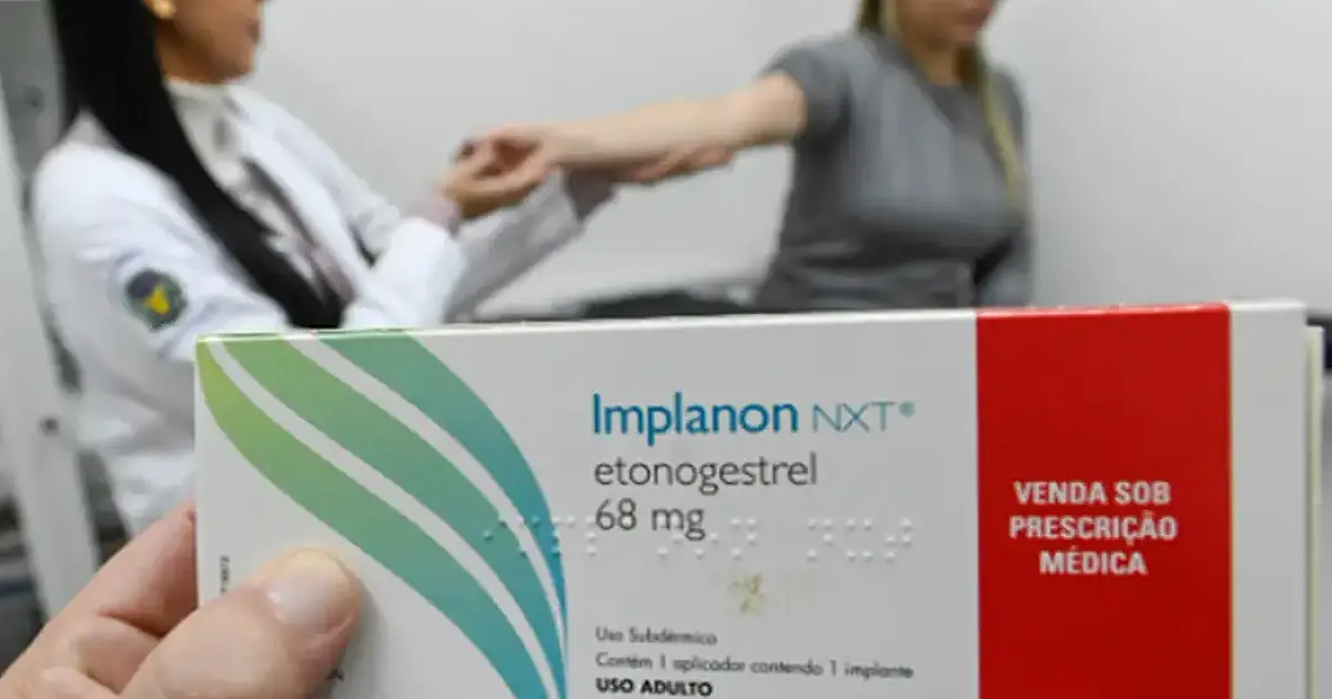 Implante contraceptivo deve ser ofertado por planos a partir de hoje