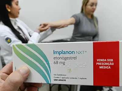 Implante contraceptivo deve ser ofertado por planos a partir de hoje