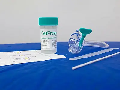 Guia orienta sobre mudança no rastreamento do câncer de colo do útero