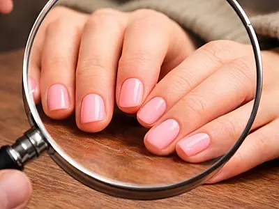 O problema nunca foram as unhas