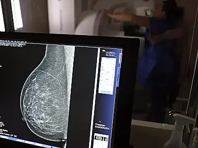 Nova lei reforça direito a três folgas por ano para exames preventivos