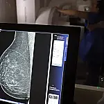 Nova lei reforça direito a três folgas por ano para exames preventivos