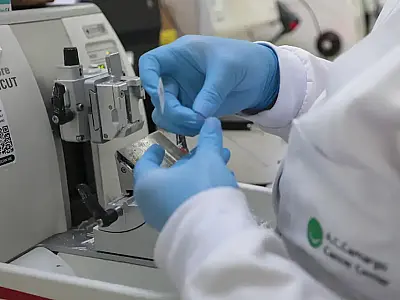 Nova lei amplia acesso a terapias e vacinas contra o câncer no SUS