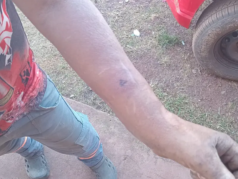 Trabalhador rural é a terceira vítima de picada de cobra em três dias no Pantanal