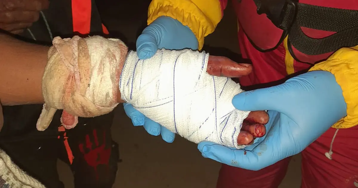 Corpo de Bombeiros resgata trabalhador ribeirinho ferido na região do Amolar